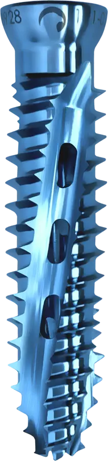 Falco implant